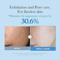 Medicube Zero Pore One-day Serum 30mL