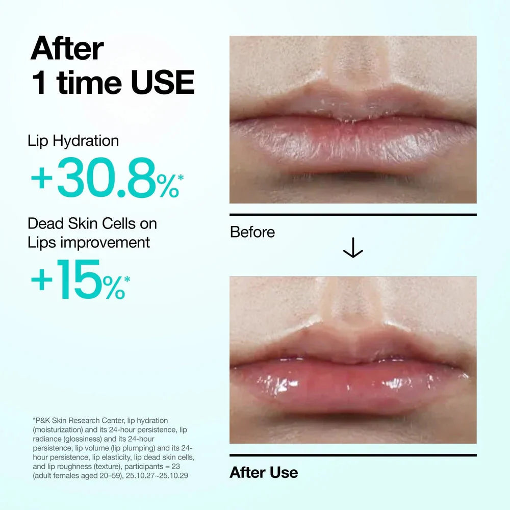 Anua PDRN Hyaluron Lip Serum 10mL