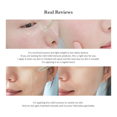 Dr. Althea Skin Relief Essence 30 mL