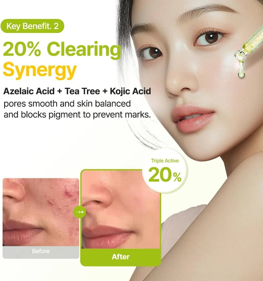 PURITO SEOUL Azelaic Acid 10 Kojic Tea Tree Serum 30mL