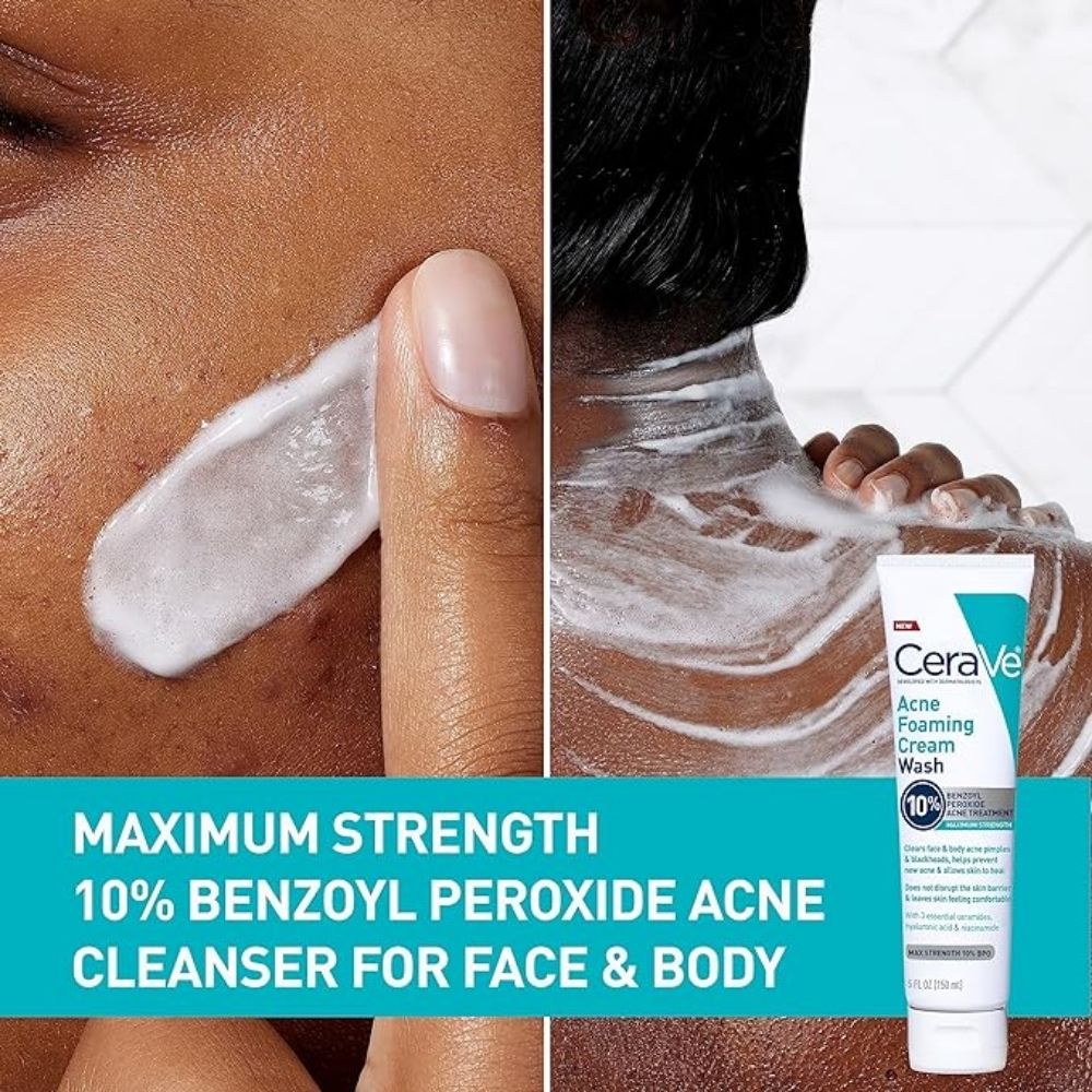 CeraVe Acne Foaming Cream Cleanser, 5 Fl Oz (Pack of 1) - Beauty Elegant