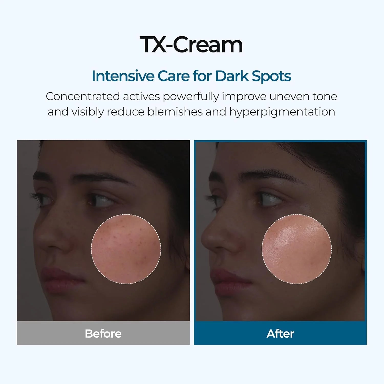 Dr. Melaxin TX Cream 50g