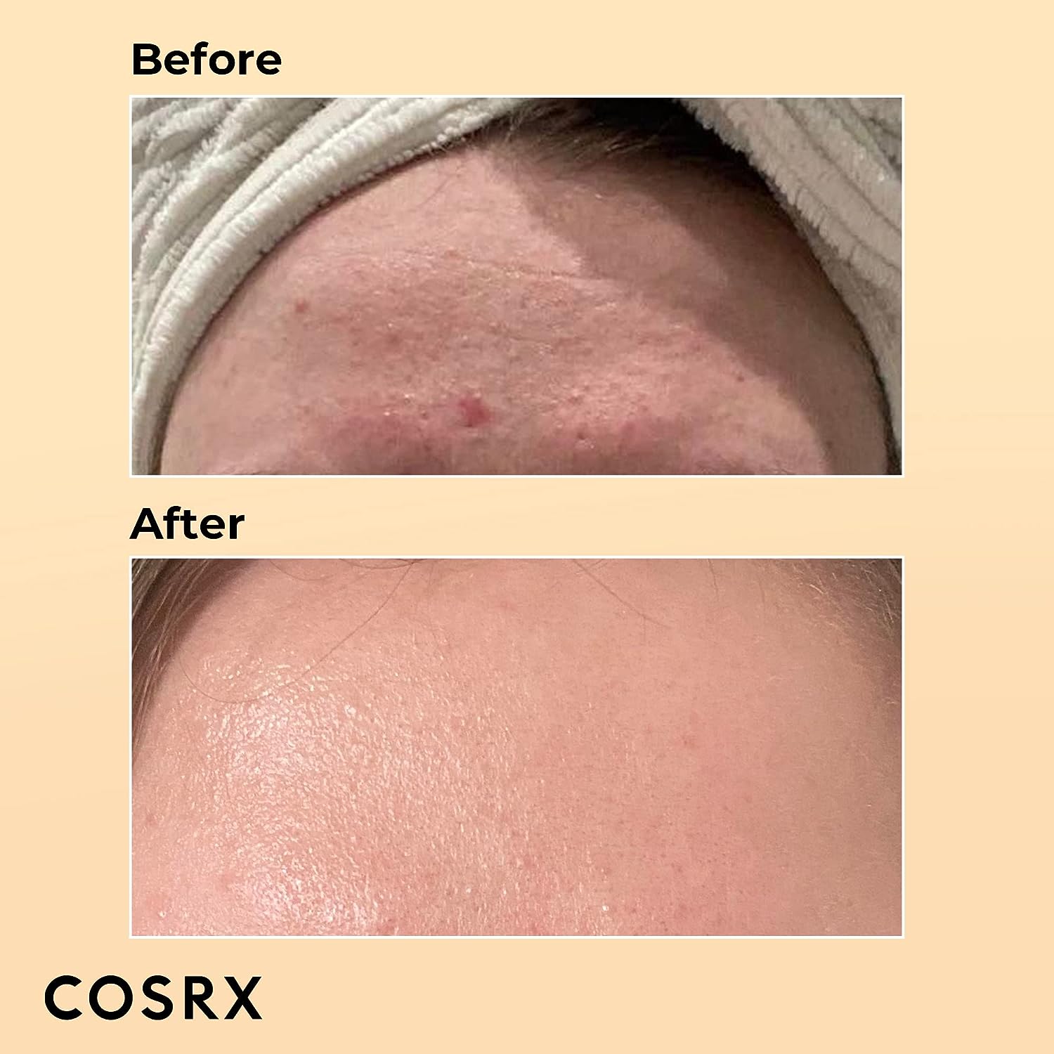DEAL OF COSRX 02 - Beauty Elegant