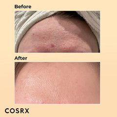DEAL OF COSRX 02 - Beauty Elegant