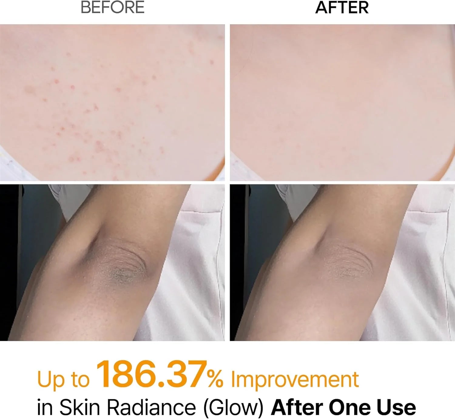 Dr. Melaxin Kojic Acid Turmeric Body Spray 200mL